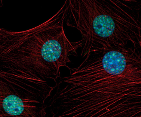 HP1 gamma Antibody in Immunocytochemistry (ICC/IF)