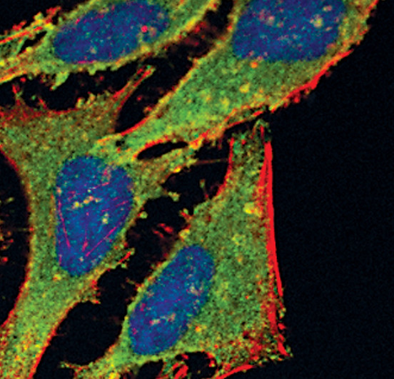 Calcineurin A Antibody in Immunocytochemistry (ICC/IF)