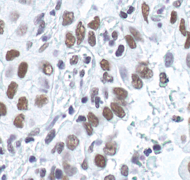 Ku80 Antibody in Immunohistochemistry (Paraffin) (IHC (P))