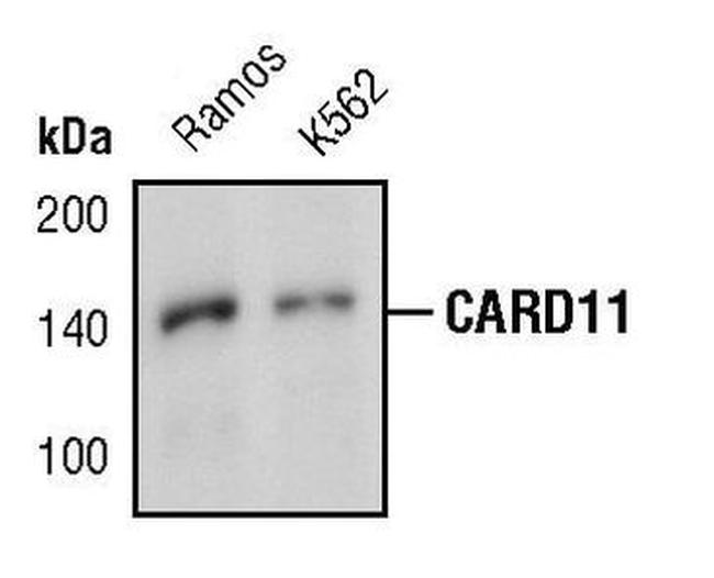 CARD11 Antibody in Western Blot (WB)