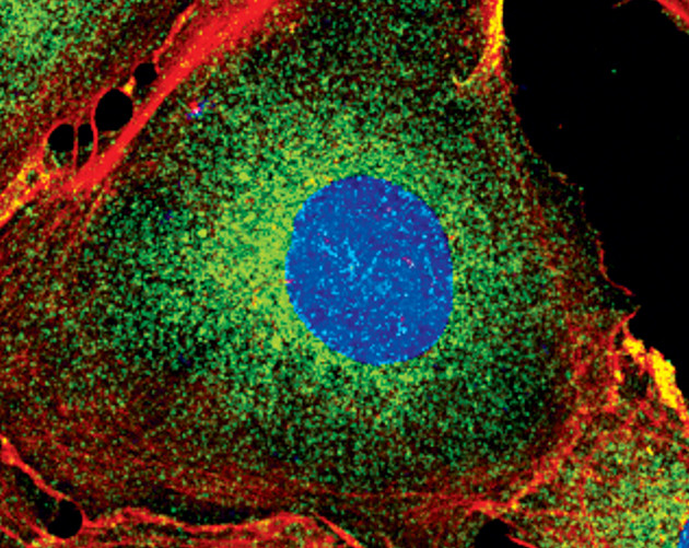 IRAK1 Antibody in Immunocytochemistry (ICC/IF)