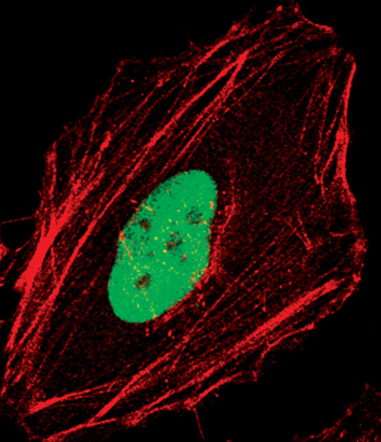 SKP2 Antibody in Immunocytochemistry (ICC/IF)