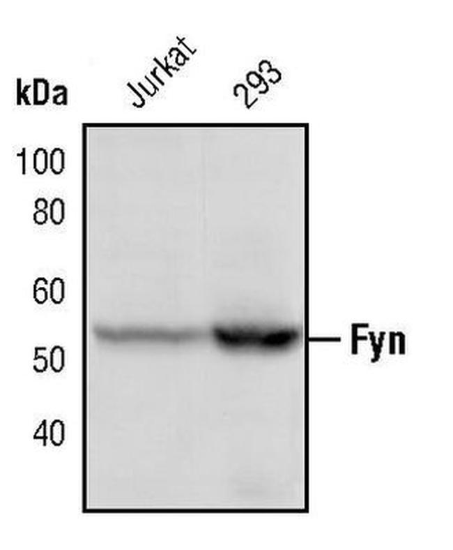 Fyn Antibody in Western Blot (WB)