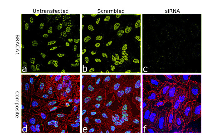 BRCA1 Antibody in Immunocytochemistry (ICC/IF)