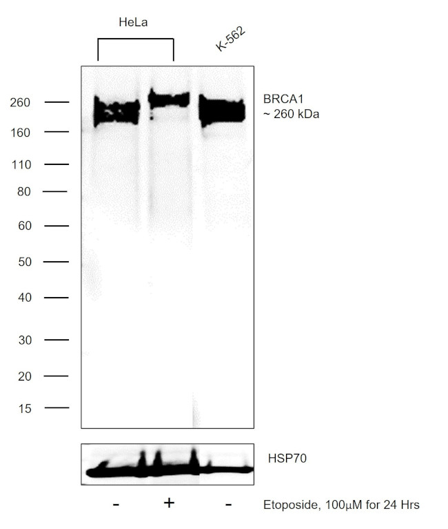 BRCA1 Antibody in Western Blot (WB)