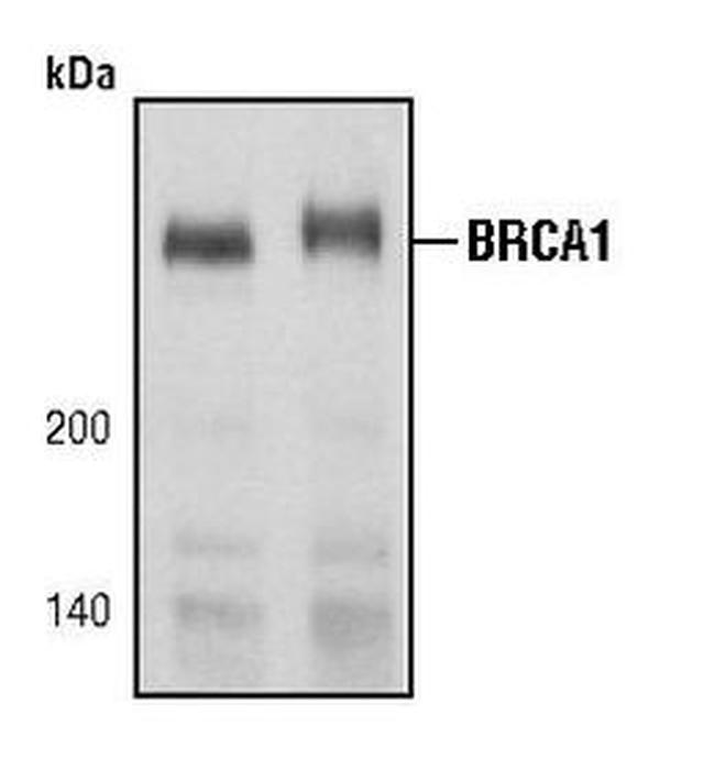 BRCA1 Antibody in Western Blot (WB)