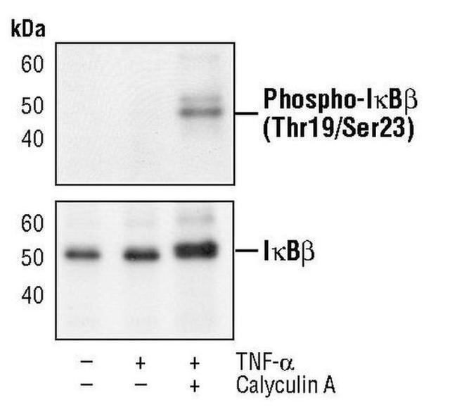 Phospho-IkB beta (Thr19, Ser23) Antibody