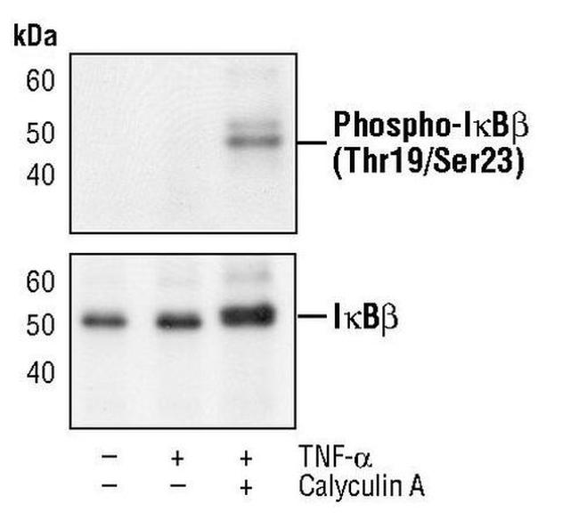 Phospho-IkB beta (Thr19, Ser23) Antibody in Western Blot (WB)