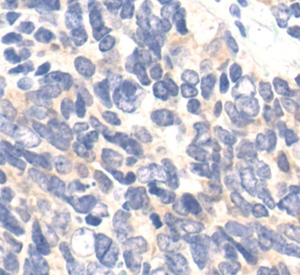 Ezrin Antibody in Immunohistochemistry (Paraffin) (IHC (P))