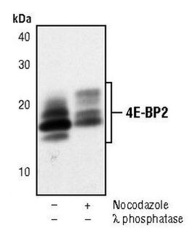 4E-BP2 Antibody in Western Blot (WB)