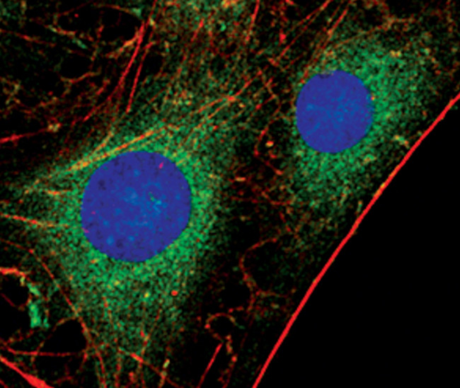 PKC alpha Antibody in Immunocytochemistry (ICC/IF)