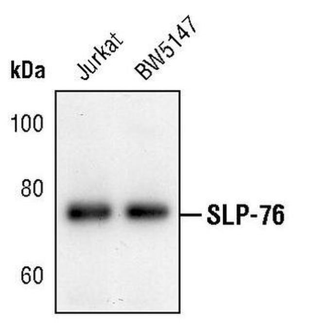 SLP76 Antibody in Western Blot (WB)