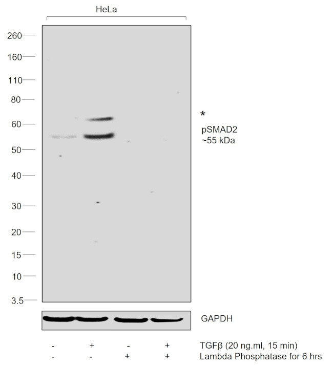 Phospho-SMAD2 (Ser245, Ser250, Ser255) Antibody