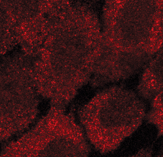 Acetyl-CoA Carboxylase Antibody in Immunocytochemistry (ICC/IF)