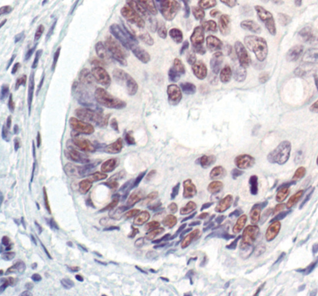 MRE11 Antibody in Immunohistochemistry (Paraffin) (IHC (P))