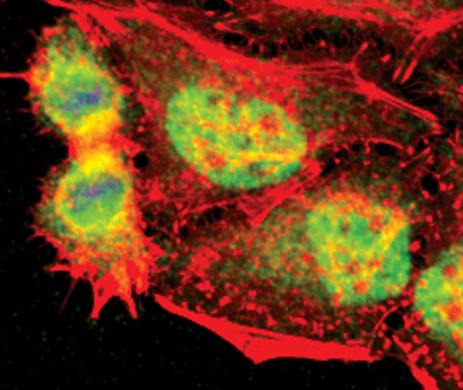 TLK1 Antibody in Immunocytochemistry (ICC/IF)