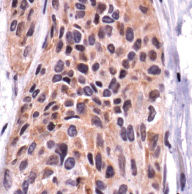 FAK Antibody in Immunohistochemistry (Paraffin) (IHC (P))