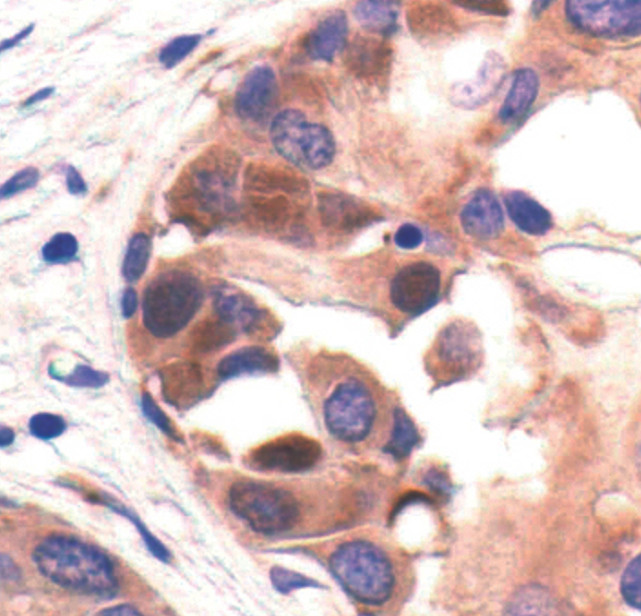 PABP Antibody in Immunohistochemistry (Paraffin) (IHC (P))