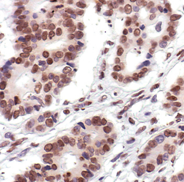 Histone H2A Antibody in Immunohistochemistry (Paraffin) (IHC (P))