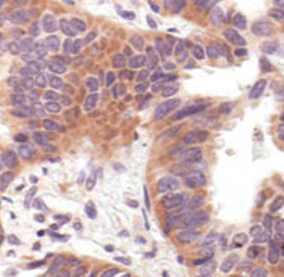 COX2 Antibody in Immunohistochemistry (Paraffin) (IHC (P))