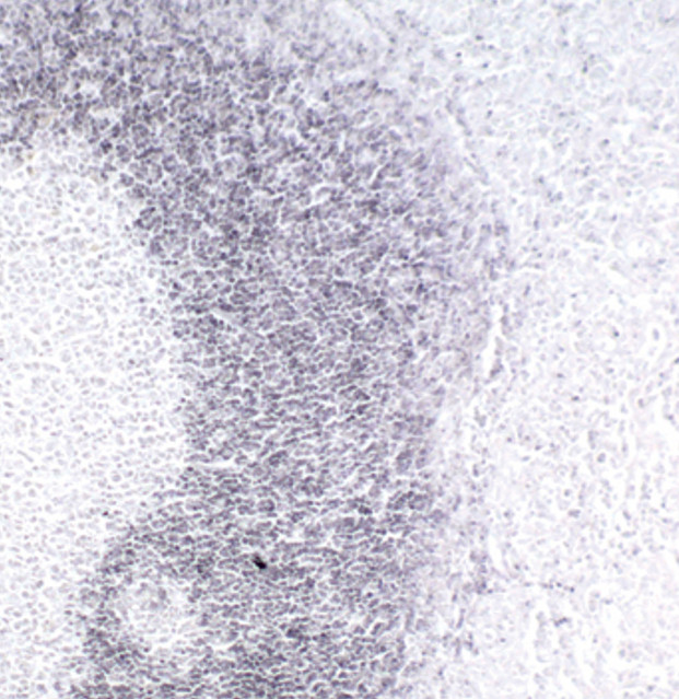 TCL1A Antibody in Immunohistochemistry (Paraffin) (IHC (P))