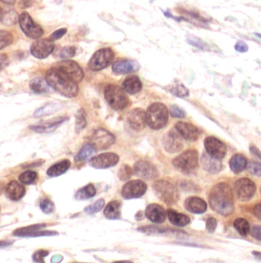 PKMYT1 Antibody in Immunohistochemistry (Paraffin) (IHC (P))