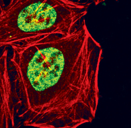 Phospho-Glucocorticoid Receptor (Ser211) Antibody in Immunocytochemistry (ICC/IF)