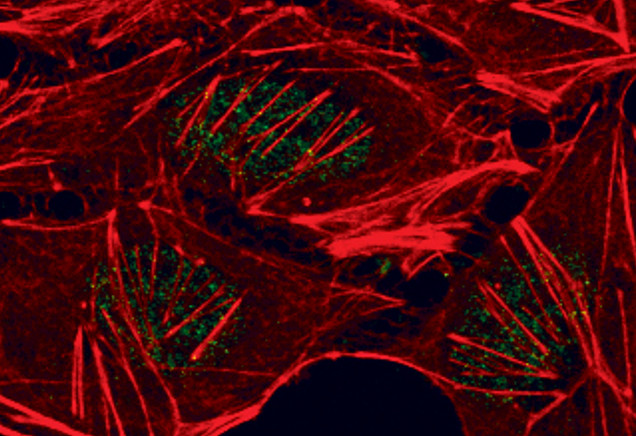 Phospho-Glucocorticoid Receptor (Ser211) Antibody in Immunocytochemistry (ICC/IF)