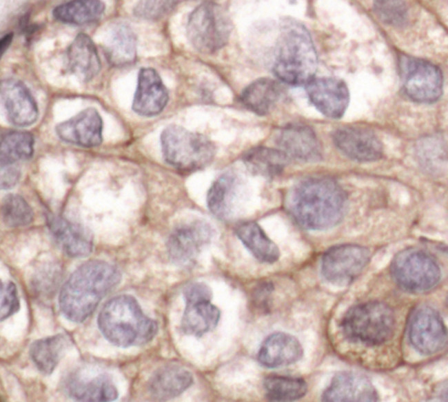 Cortactin Antibody in Immunohistochemistry (Paraffin) (IHC (P))