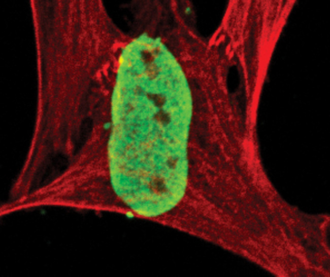 H4K12ac Antibody in Immunocytochemistry (ICC/IF)