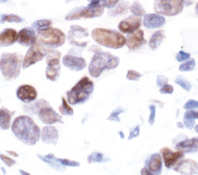 H2BK5ac Antibody in Immunohistochemistry (Paraffin) (IHC (P))