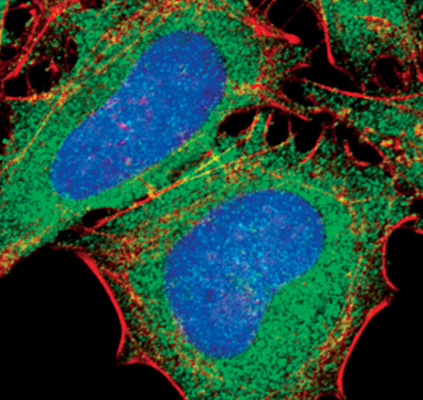 EEF2 Antibody in Immunocytochemistry (ICC/IF)