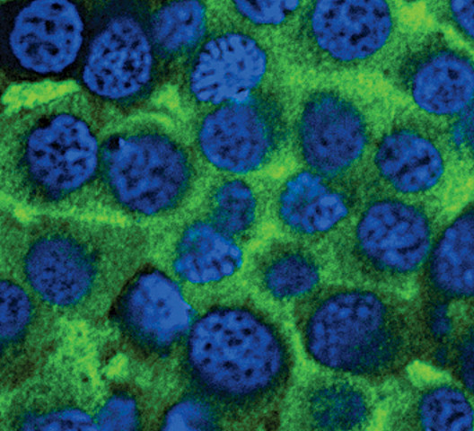 Tyrosine Hydroxylase Antibody in Immunocytochemistry (ICC/IF)