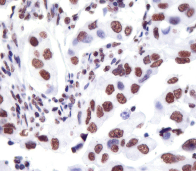 H3K18ac Antibody in Immunohistochemistry (Paraffin) (IHC (P))