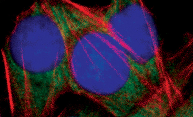 Phospho-eIF4G (Ser1108) Antibody in Immunocytochemistry (ICC/IF)