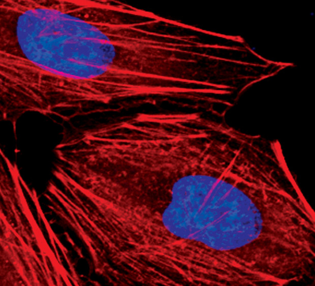 Lamin A (Cleaved Asp230) Antibody in Immunocytochemistry (ICC/IF)