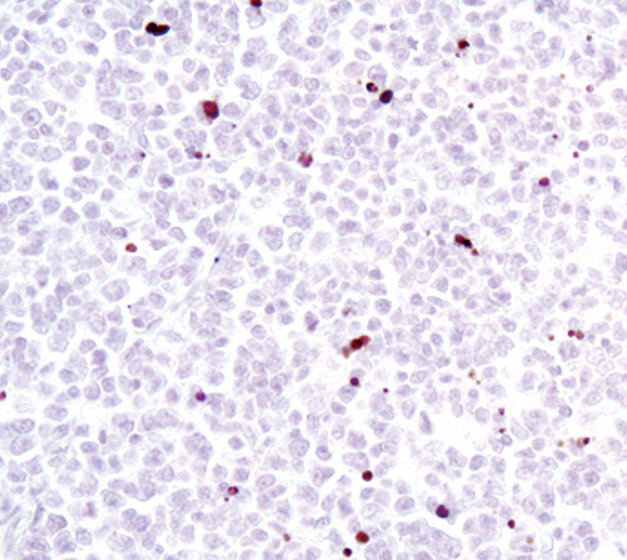 Lamin A (Cleaved Asp230) Antibody in Immunohistochemistry (Paraffin) (IHC (P))