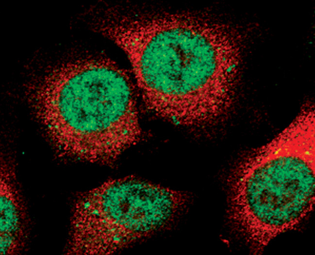 Phospho-STAT3 (Ser727) Antibody in Immunocytochemistry (ICC/IF)