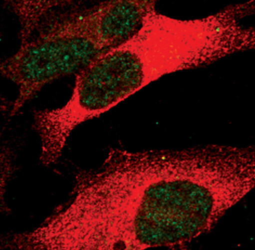 Phospho-STAT3 (Ser727) Antibody in Immunocytochemistry (ICC/IF)