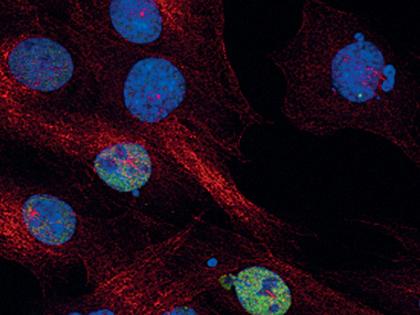 Phospho-c-Jun (Ser73) Antibody in Immunocytochemistry (ICC/IF)