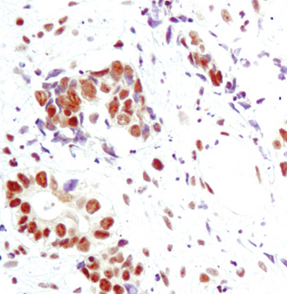 Phospho-ATF2 (Thr69, Thr71) Antibody in Immunohistochemistry (IHC)