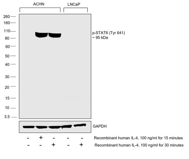 Phospho-STAT6 (Tyr641) Antibody in Western Blot (WB)