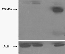 Tankyrase 2 Antibody in Western Blot (WB)