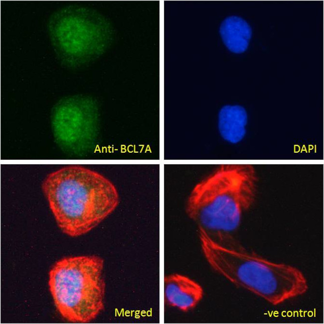 BCL7A Antibody in Immunocytochemistry (ICC/IF)