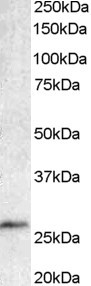 BCL7A Antibody in Western Blot (WB)