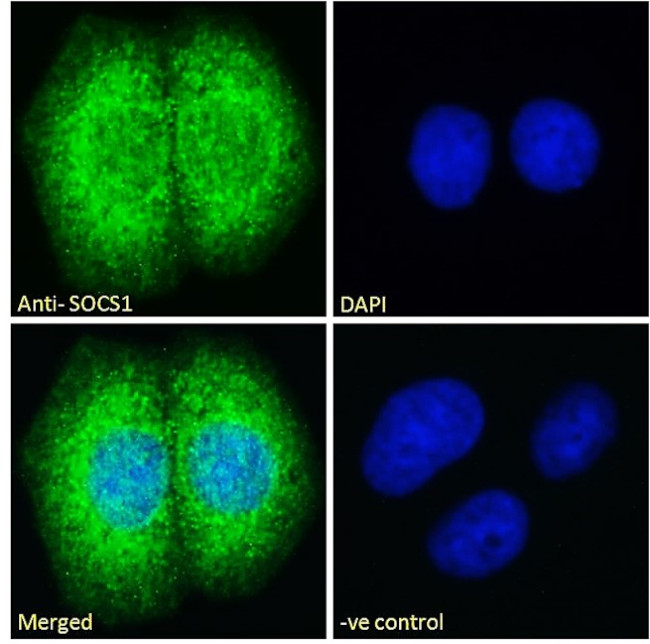 SOCS1 Antibody in Immunocytochemistry (ICC/IF)