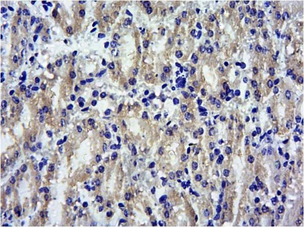 SOCS1 Antibody in Immunohistochemistry (Paraffin) (IHC (P))