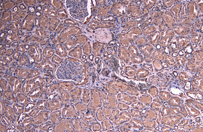 SOCS1 Antibody in Immunohistochemistry (Paraffin) (IHC (P))