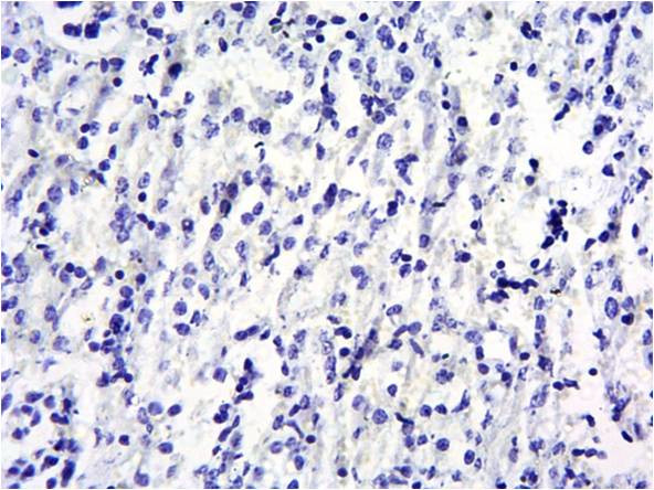 SOCS1 Antibody in Immunohistochemistry (Paraffin) (IHC (P))