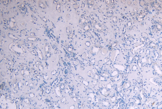 SOCS1 Antibody in Immunohistochemistry (Paraffin) (IHC (P))